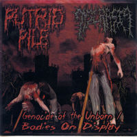 Putrid Pile - Genocide Of The Unborn-Bodies On Display